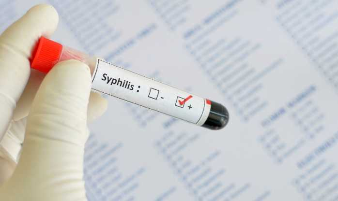Brasil enfrenta epidemia de sífilis: saiba como se proteger