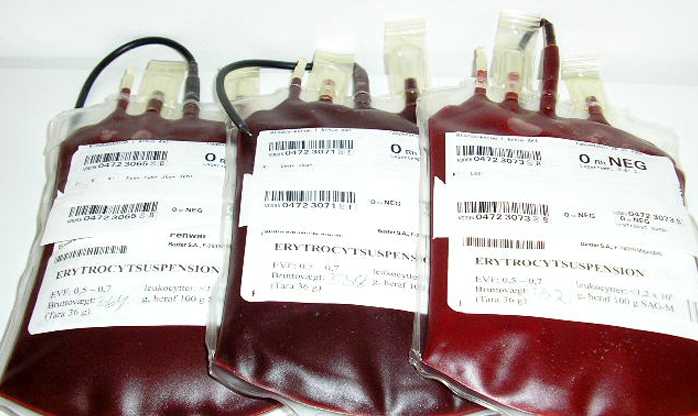 Cientistas criam sangue em laboratório pela primeira vez