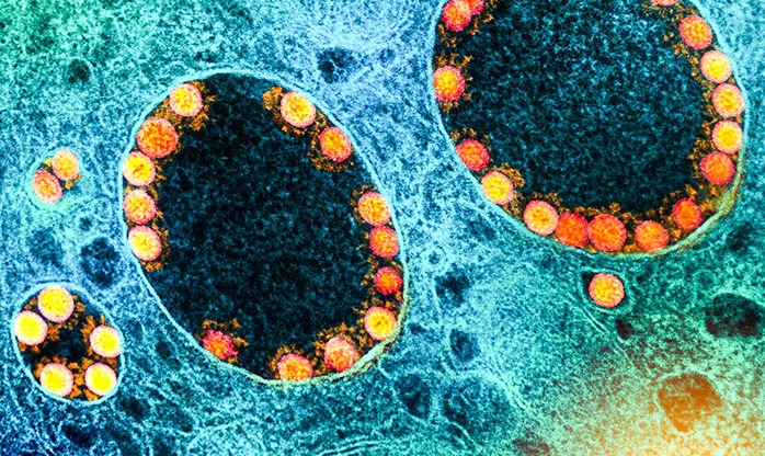 França identifica nova variante do coronavírus com mais de quarenta mutações
