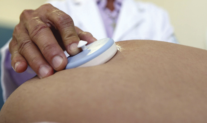 Experimento com ratos mostra que zika aumenta chance de aborto no início da gravidez