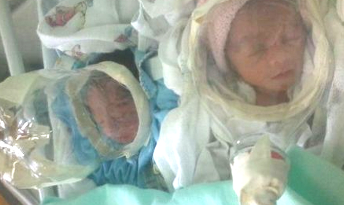 Bebê atendido com máscara de oxigênio de garrafa pet é transferido para Manaus
